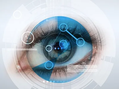 Cirurgia de Glaucoma